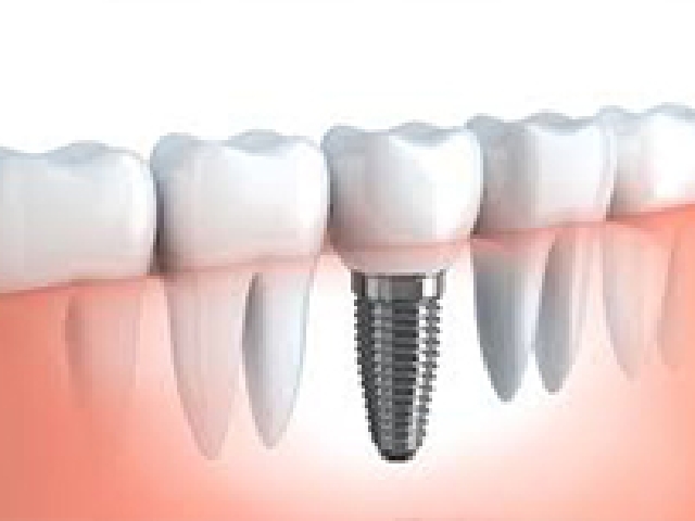 難易度の高いケースにも対応