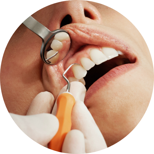 歯科衛生士によるメンテナンス