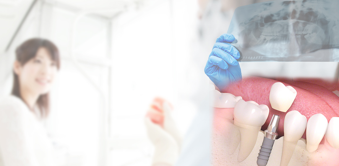 インプラント｜北山田グリーンデンタルクリニック